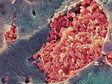 Red Blood Cells Under Electron Microscope Ulabduenhas
