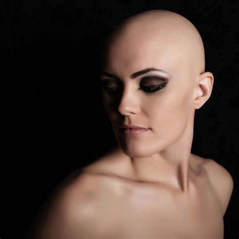 Stacie Dudas Page Alopecia World