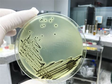 Staphylococcus Aureus Grow On Baird Parker Agar Stock Photo Image Of