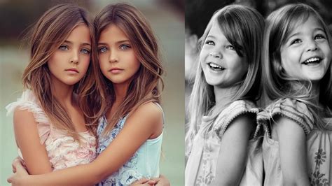 Can We Remember The Worlds Most Beautiful Twins 10 Years Ago See