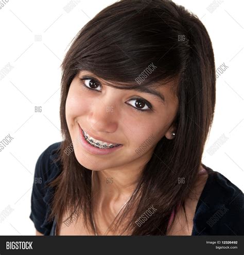 Smiling Braces Image And Photo Free Trial Bigstock