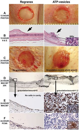 Rapid Granulation Tissue Regeneration By Intracellular Atp Delivery A