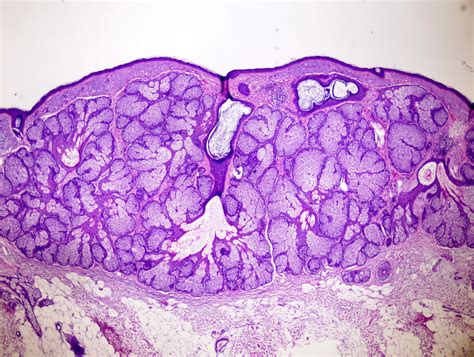 Sebaceous Glands Histology