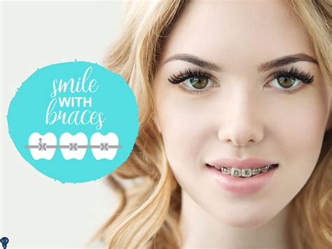 Common Problems With Braces And How To Fix Them