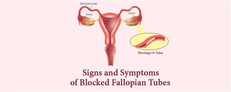 Signs And Symptoms Of Blocked Fallopian Tubes And Ayurvedic Treatment