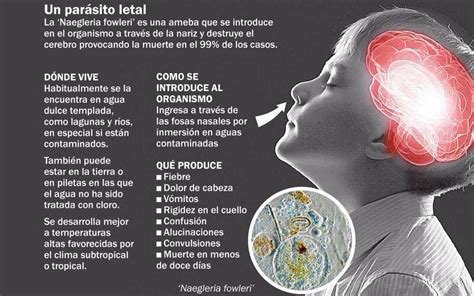 Una mujer australiana que había sido declarada con muerte cerebral recuperó la conciencia después de semanas de lucha contra las recomendaciones del doctor para que se apagara su ventilador, según un informe publicado ayer en el northern territory news. Qué es la ameba come cerebro que ya mató a un niño ...