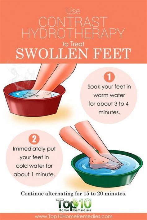Top 10 Natural Home Remedies For Swollen Feet Jointpainrelief