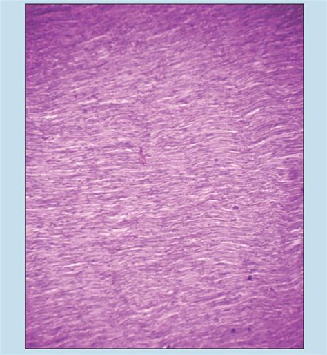 Chapter 3 Connective Tissue Proper Histology An Identification Manual