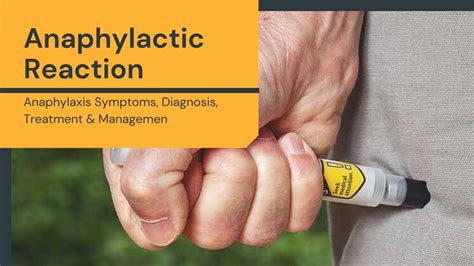 Anaphylactic Reaction Anaphylaxis Symptoms Diagnosis Treatment