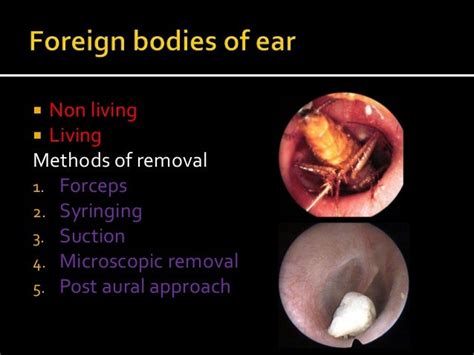 Diseases Of The External Ear