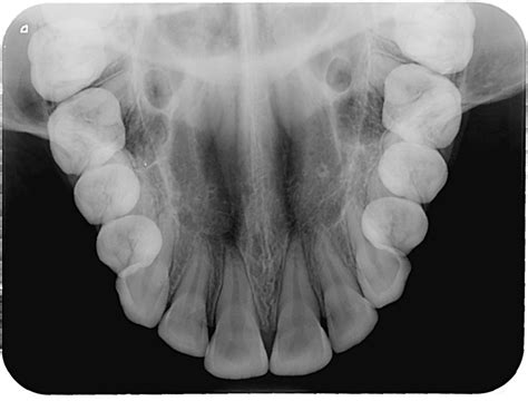 RadiografÍas Dentales