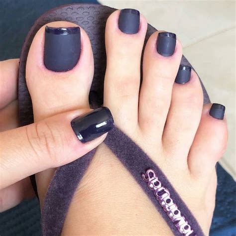 Pin By James Rogers On Healing Black Toe Nails Pretty Toe Nails
