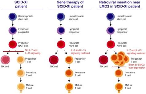 Model For Leukemogenesis In X Linked Severe Combined Immunodeficiency