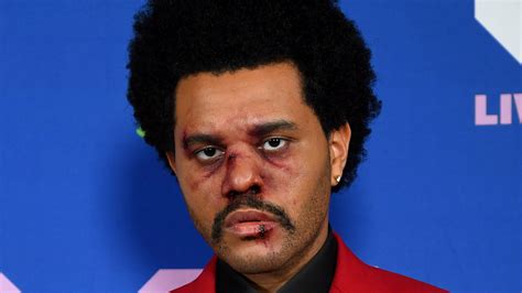 Did The Weeknd Get Plastic Surgery The Photo Explained Images And Photos Finder