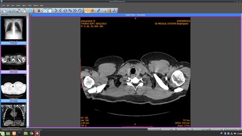 Maybe you would like to learn more about one of these? Sante DICOM Viewer Mac | How-to: Burn DICOM CD/DVD