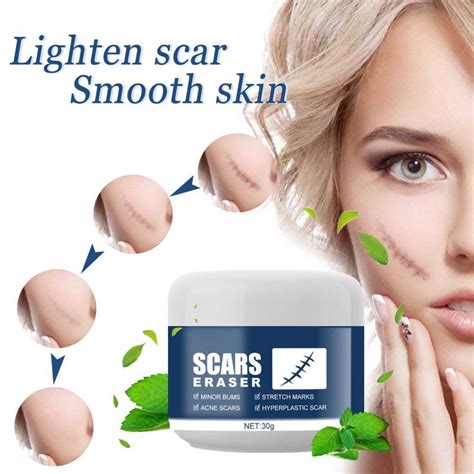 30g Scar Remove Cream Not Irritating Repair Damage Synthetic Scar