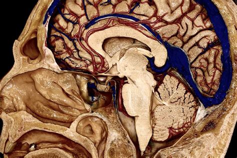 Mid Sagittal Perspective Of Right Hemisphere Brainstem And Cerebellum