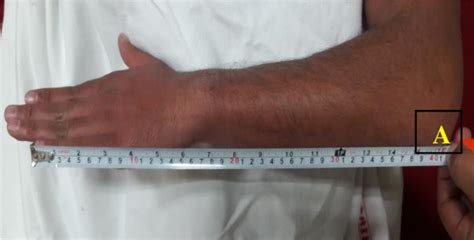 Figure 1 From Relationship Of Anatomical Lengths Of Forearm Plus Hand