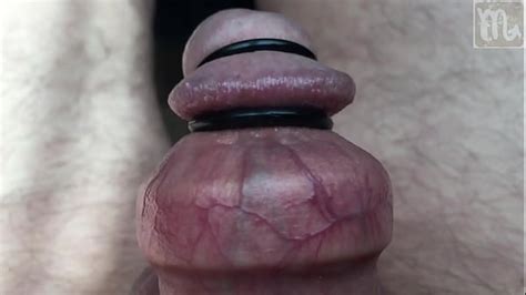 Stretched Foreskin And Rubber Band On And Under The Glandsand Xxx Mobile Porno Videos And Movies
