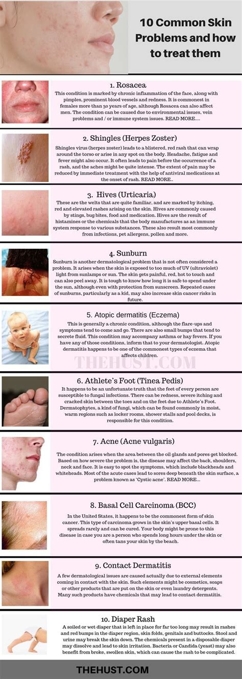 10 Common Skin Conditions And Problems Pictures And Treatments Skin Problems Skin Allergies