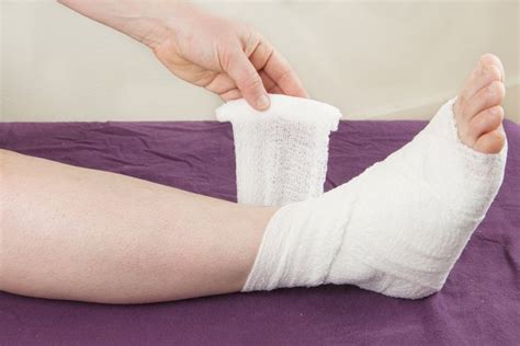 How Do I Wrap A Sprained Ankle