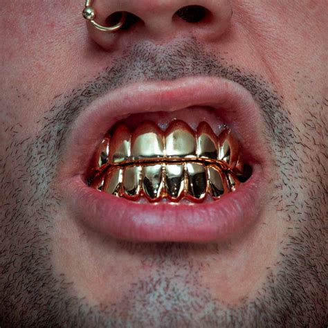 Grillz 8×8 Gold Elements Joia Dental