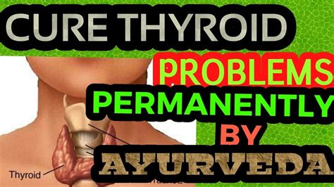How To Cure Thyroid Disorders Hypothyroidism Hyperthyroidism Goiter