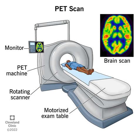 PET Scan What It Is Types Purpose Procedure Results