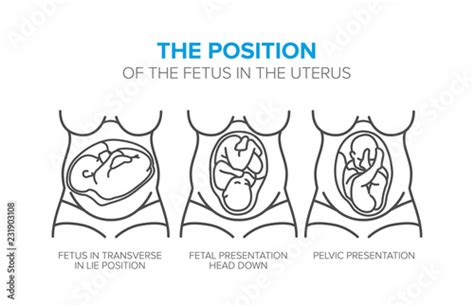 Fetal Position Drawing Reference