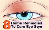 Home Remedies Eye Stye Pictures