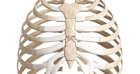 Broken Sternum From Car Accident Cathrine Butenhoff