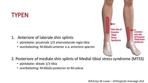 Medial Tibial Stress Syndrome