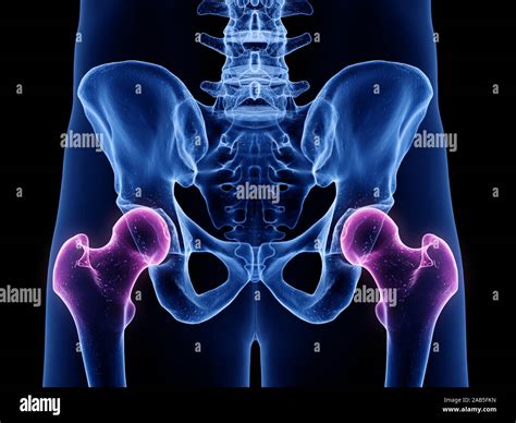 Hip Joints Hi Res Stock Photography And Images Alamy