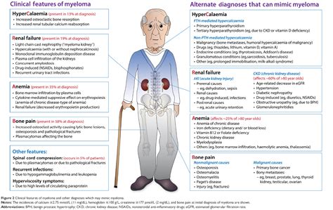 International myeloma working groupmolecular classification of multiple myeloma: Multiple Myeloma And Kidney Failure Life Expectancy ...
