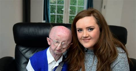 Disabled Pensioner Alan Barnes Attacked By Mugger Meets Kind Hearted