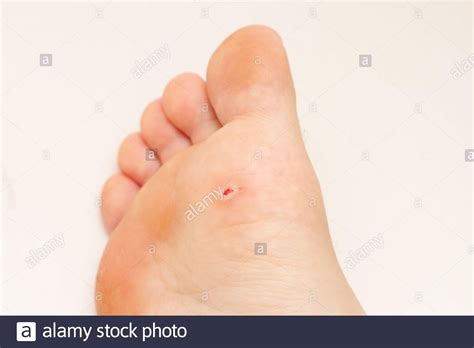 Sole Of Foot High Resolution Stock Photography And Images Alamy