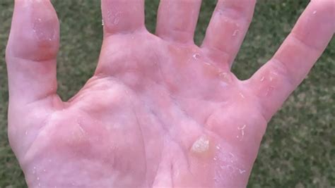 Fan account retweeting news and the love for twitterless, norwegian golfer viktor hovland. Viktor Hovland's hand looks like he stuck it in a sausage ...