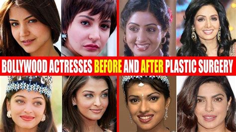 Top 10 Bollywood Actresses Before And After Plastic