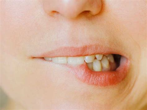 Popping A Cold Sore What Happens And What To Do Instead