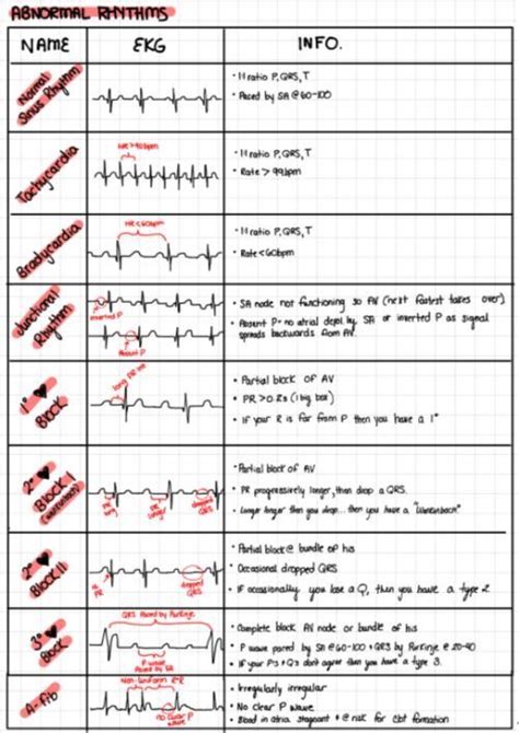 Pin By Gabrielle Rosati On Cardio Nursing School Notes Medical