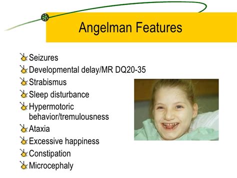 Angelman Syndrome Onset Acne Symptoms Hot Sex Picture