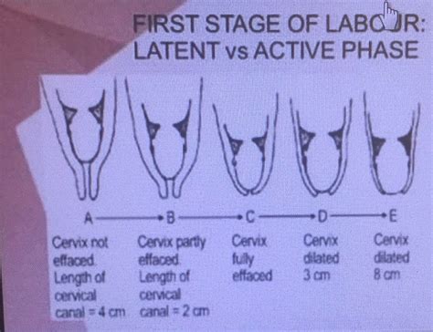 First Stage Of Labour Stages Of Labor Cervix Nursing Word Search