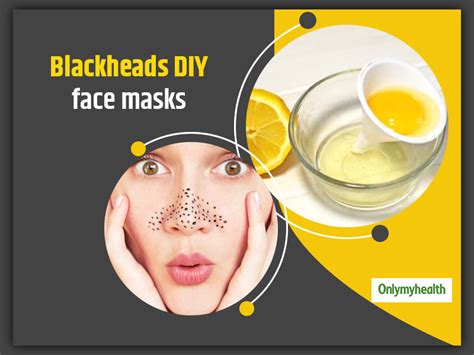 Want To Get Rid Of Blackheads Try These 6 Amazing Diy Face Masks To