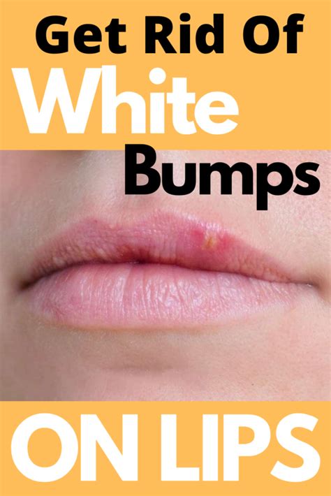 how to get rid of bumps on lips