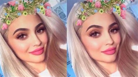Snapchat Dysmorphia Teenagers Are Getting Plastic Surgery To Look