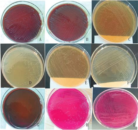 Growth Of Bacteria On Different Media And Colony Morphology Following
