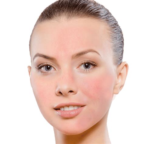 Sensitive Skin Type • Treatment And Skincare • Nascent Skin Clinic