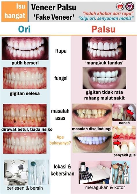 We did not find results for: Kos Buat Gigi Palsu Di Klinik Kerajaan - Berapa Kos ...