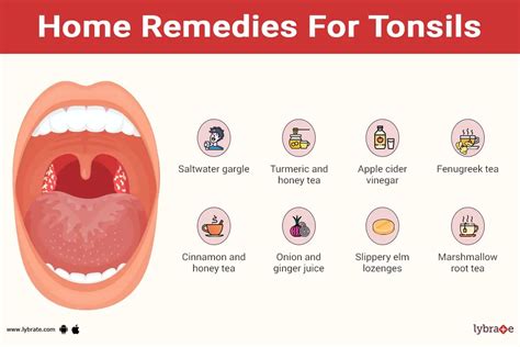 Home Remedies For Tonsils By Dr Rushalli Nair Lybrate
