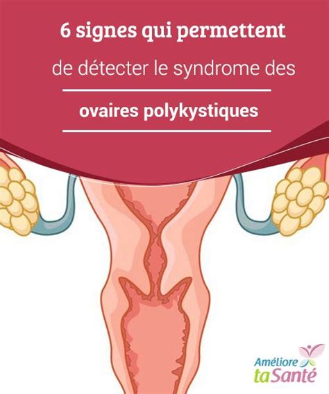 Signes Qui Permettent De D Tecter Le Syndrome Des Ovaires